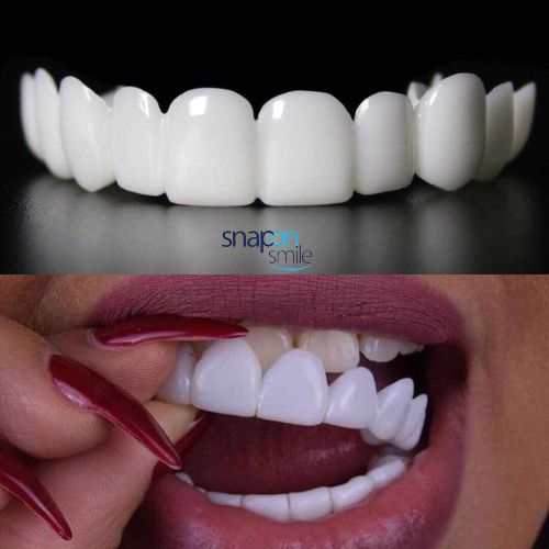 Carillas Dentales de Resina - Snap on Smile 🦷 - EC