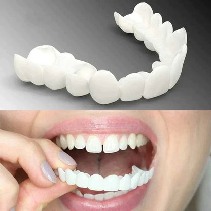 Carillas Dentales de Resina - Snap on Smile 🦷 - EC