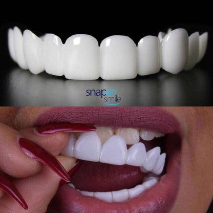 Carillas Dentales de Resina - Snap on Smile 🦷 - EC
